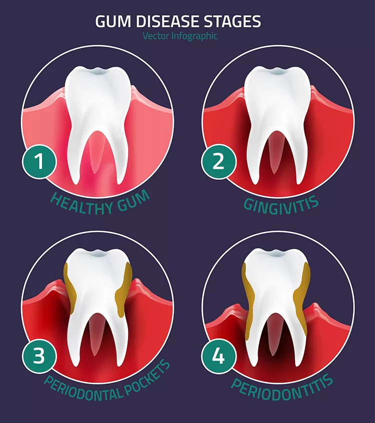 Understanding Oral Health: Why It’s Important for Men and Their Dental Risks