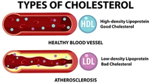 types of cholesterol